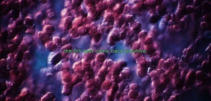 Doorbraak hiv-genezing dankzij nieuwe mRNA-technologie